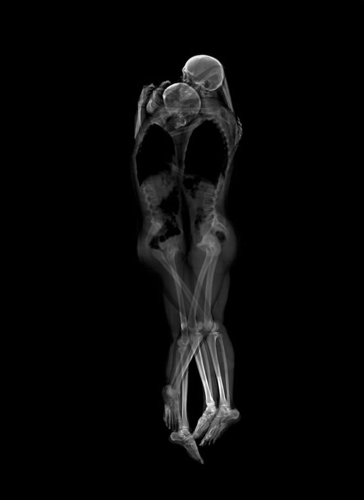X-Ray Portraits, an artistic photograph of two people in close embrace. We see their skeletons against a black background.